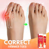 Load image into Gallery viewer, Bunion Toe Relief Cream