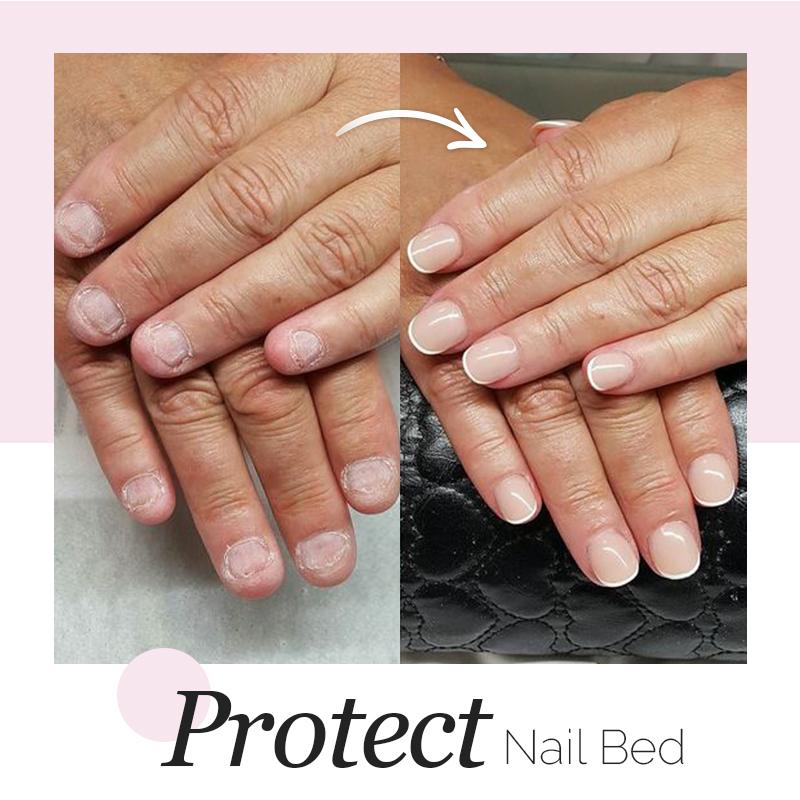 Instant Nail Repair Gel
