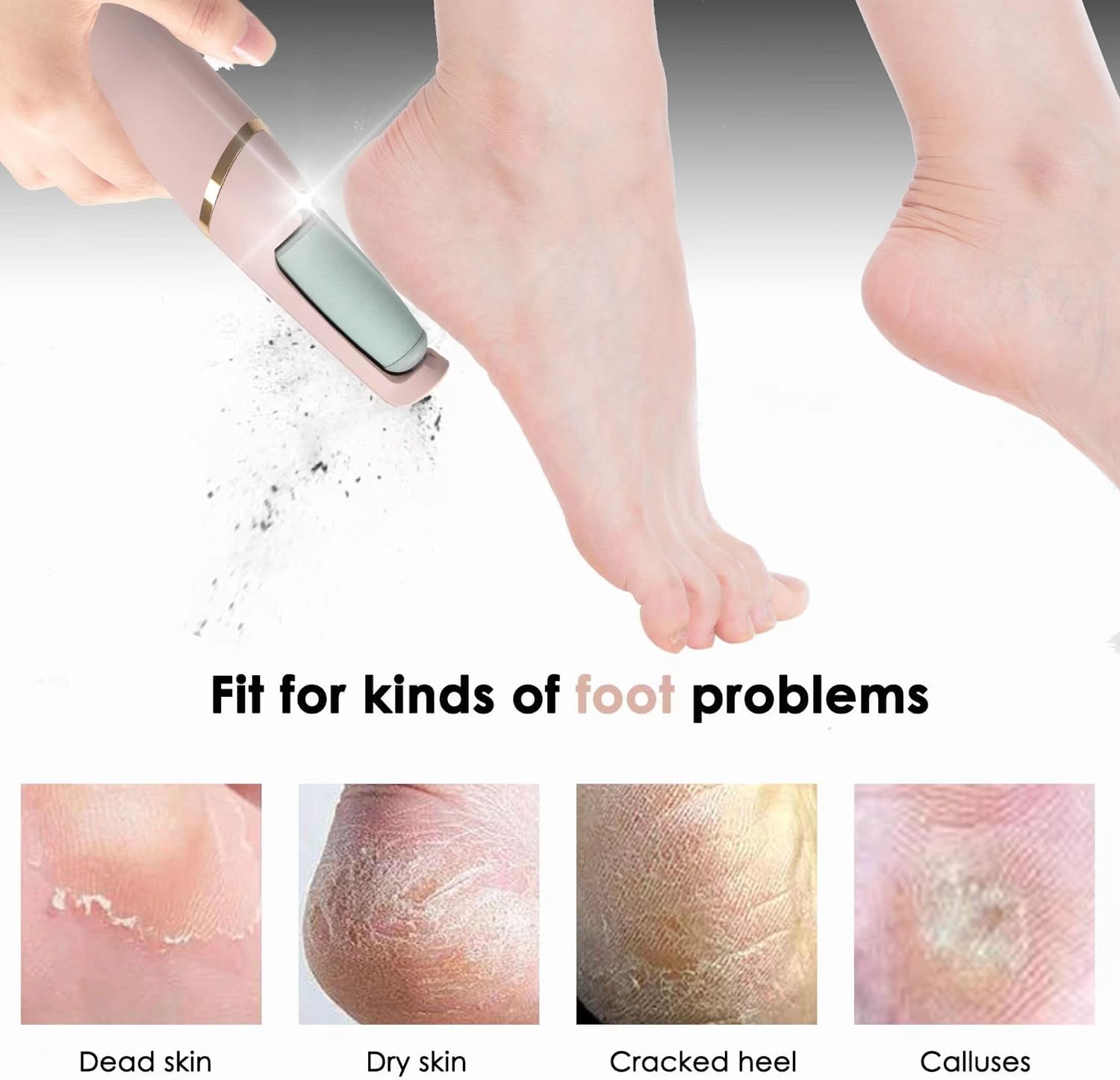 ProFoot Electric Callus Remover: Silky Smooth Feet in Seconds