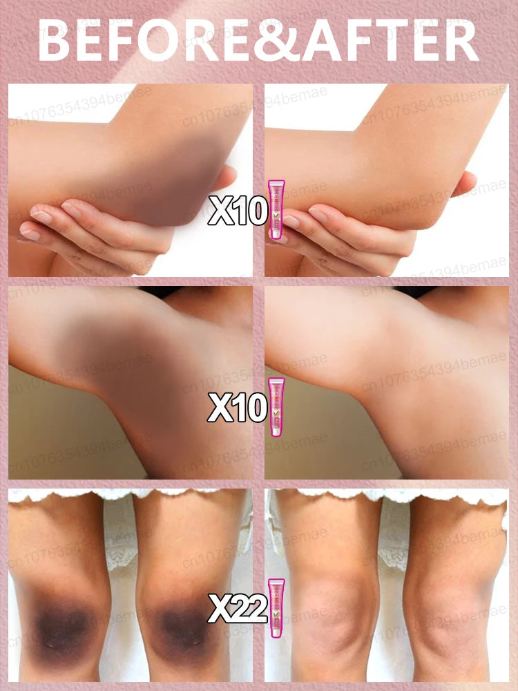Best Offer💎BUY 2 GET 1 FREE💎 Intimate Whitening Cream