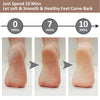 ProFoot Electric Callus Remover: Silky Smooth Feet in Seconds