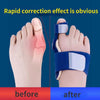 Load image into Gallery viewer, Ultimate Bunion Relief: Big Bone Toe Corrector for Foot Pain Care
