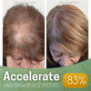 Load image into Gallery viewer, ReGrowth Nourishing Ginger Hair Spray
