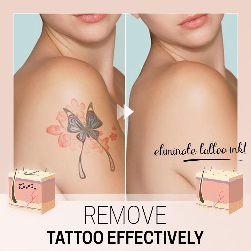 TatEraser™ Tattoo Removal Cream