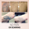 TatEraser™ Tattoo Removal Cream