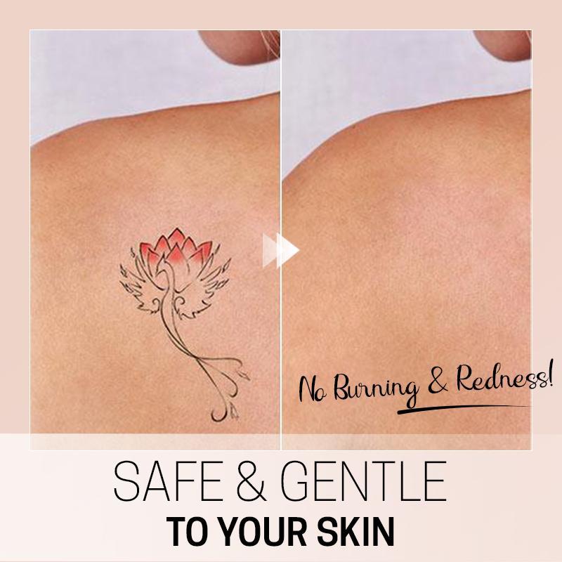 TatEraser™ Tattoo Removal Cream
