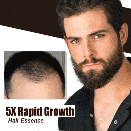 5X Rapid Growth Hair Essence