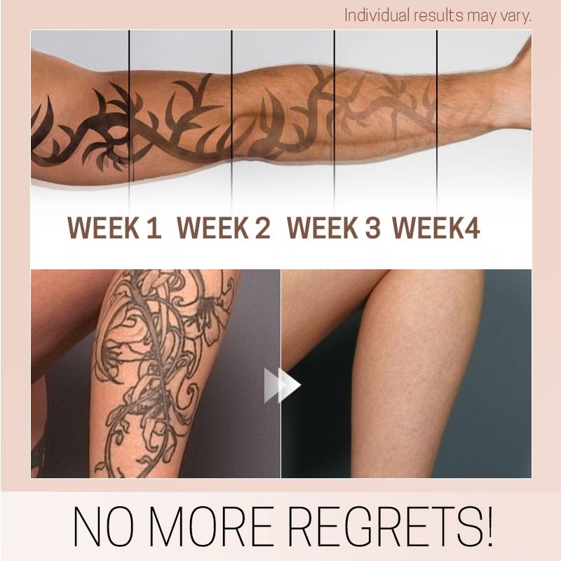 TatEraser™ Tattoo Removal Cream
