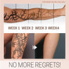 TatEraser™ Tattoo Removal Cream